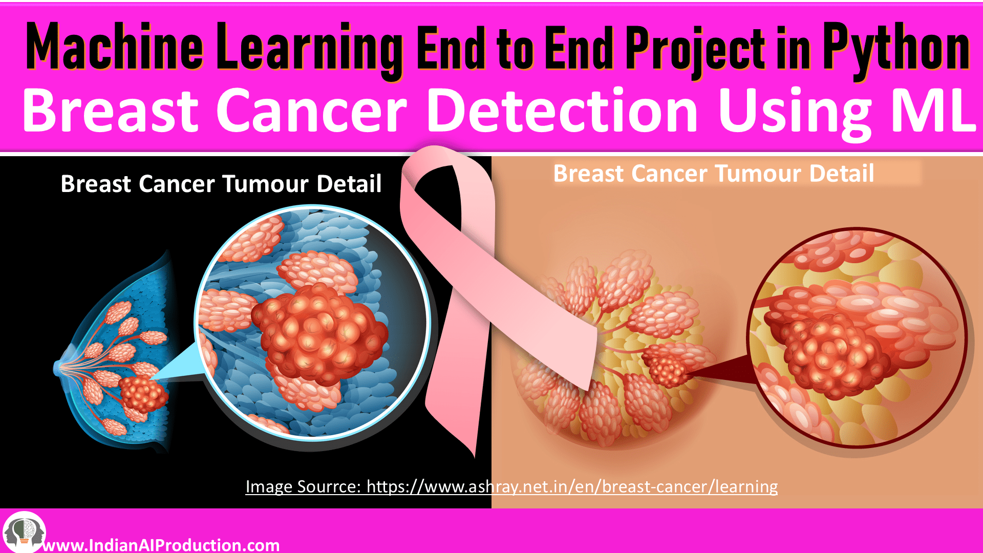 cancer_detection_machine_learning