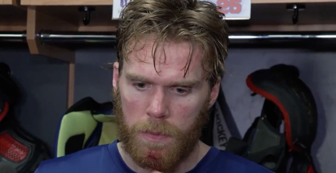 Trend visualization for mcdavid comments coaching oilers loss